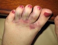 MyFoot2-pUQBGO.jpg
