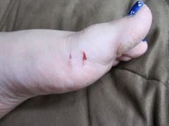 Injuries-5ZaMJD.jpg